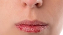 Lời khuyên về cách chăm sóc đôi môi của bạn ảnh 2