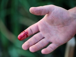 9 cách cầm máu vết thương nhanh chóng tại nhà