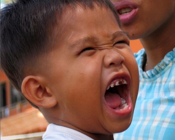 Sún răng ở trẻ  Nguyên nhân và 4 cách điều trị hiệu quả  Nha Khoa Quốc Tế