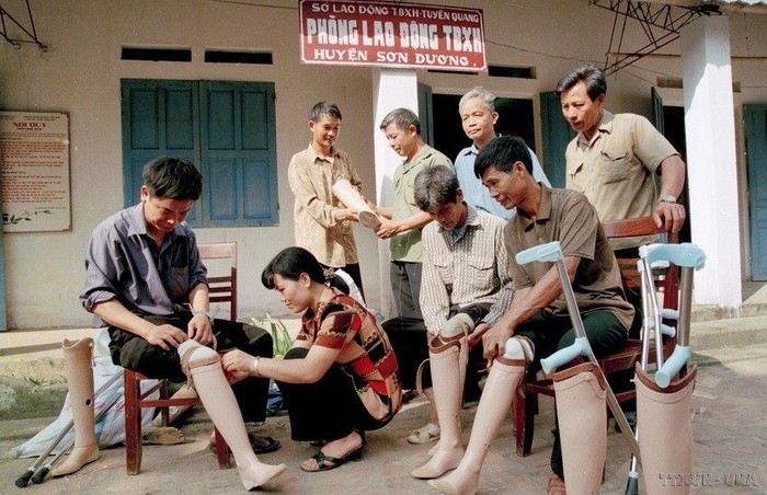 Cấp chân giả cho các thương binh tại tỉnh Tuyên Quang. (Ảnh: Trần Tuấn/TTXVN)