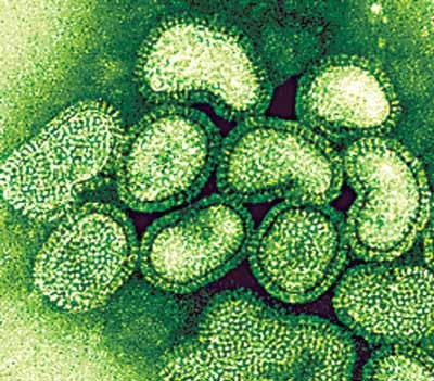 5. Bệnh liên cầu khuẩn ở lợn do Streptococcus suis gây ra và có khả năng lây lan sang người. Streptococcus suis là một liên cầu, có hình ô van, hình bầu dục, bắt màu Gram (+) và sắp sếp thành chuỗi. Bệnh liên cầu khuẩn là bệnh truyền nhiễm có thể xảy ra ở hầu hết các loài động vật máu nóng, trong đó có lợn và người.