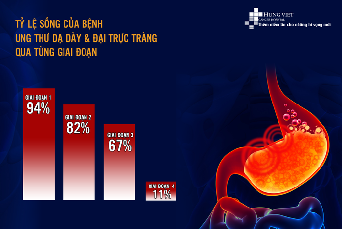 Tỷ lệ sống của ung thư dạ dày phụ thuộc vào thời gian phát hiện bệnh (Ảnh: Bệnh viện Ung bướu Hưng Việt)