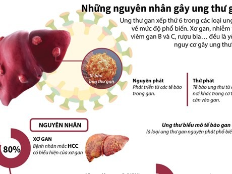 Ngoài ung thư phổi, ung thư dạ dày, ung thư gan là một trong những loại bệnh Việt Nam đứng top đầu thế giới. (Ảnh: Thông tấn xã Việt Nam)
