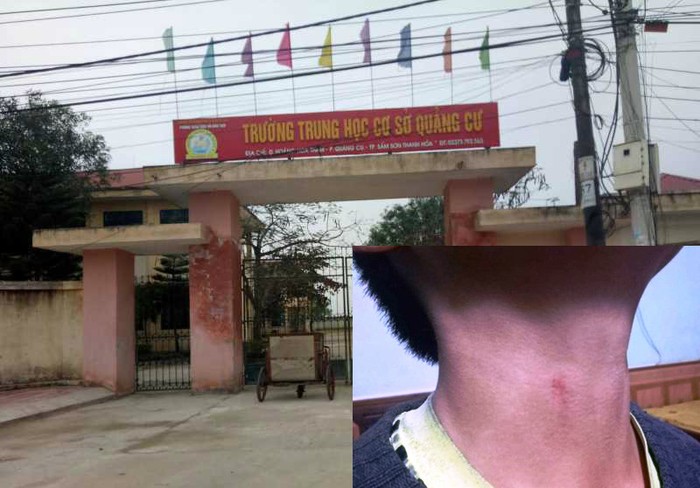 Trường Trung học cơ sở Quảng Cư (Sầm Sơn, Thanh Hóa) nơi xảy ra vụ việc. (Ảnh: PHHS cung cấp)