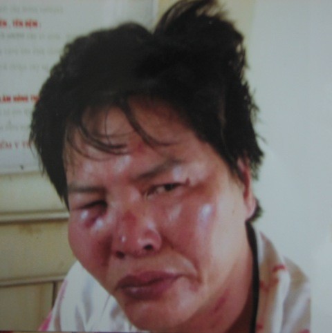 Hình ảnh chụp lại hôm ông Quang bị đánh "hội đồng" ngày 19/6/2011