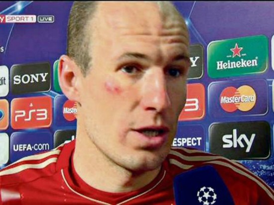 Robben bị Ribery đánh bầm mặt