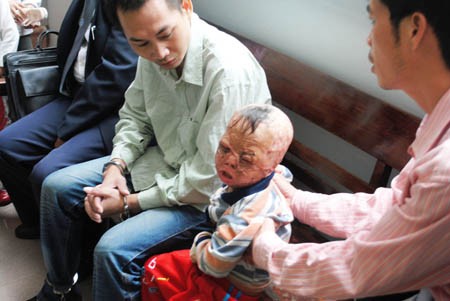 Vũ Văn Quang bên đứa con bị đốt.