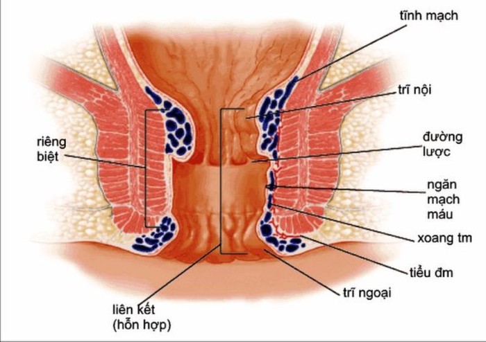 11. Trị trĩ: Lấy một nắm lá mồng tơi rửa sạch, giã nát nhuyễn cùng vài hạt muối đắp vào chỗ trĩ sưng, đồng thời nấu canh mồng tơi ăn với cá diếc (ăn cả nước và cái), rất hiệu nghiệm.