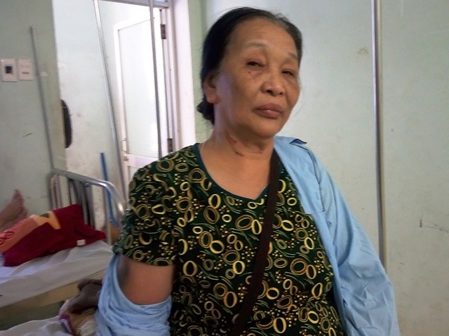 Đôi vợ chồng già ở huyện Quảng Trạch (Quảng Bình) bị một thầy giáo đánh phải nhập viện