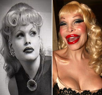 Amanda Lepore sinh ra là con trai nhưng từ bé đã chuyển đổi giới tính thành con gái. Thời kỳ đầu của sự nghiệp người mẫu, cô rất xinh đẹp, nữ tính. Nhưng cô đã trở thành thảm họa phẫu thuật thẩm mỹ với khuôn mặt biến dạng vào năm 2007..