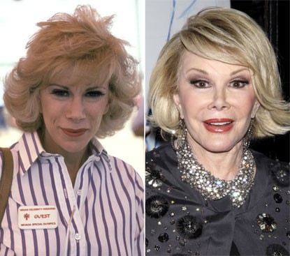 Nữ diễn viên Joan Rivers từng gây sốc khi tiết lộ rằng, cô đã trải qua 739 lần phẫu thuật. Khuôn mặt bà hoàn toàn thay đổi so với hình ảnh năm 1982.