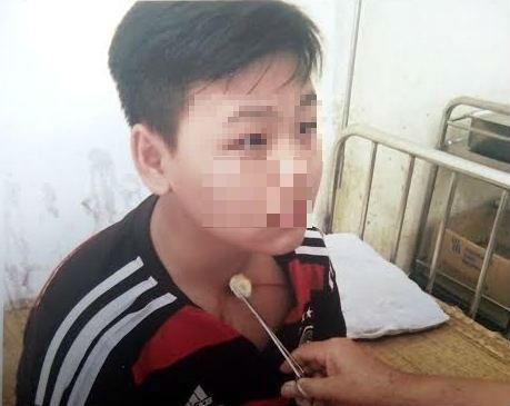 Học sinh Hoàng Nguyễn T. bị thương sau khi bị thầy Cầu hành hung (ảnh: XUÂN DU).