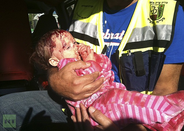 Một em bé Israel bị thương do tên lửa của Hamas bắn trúng khu vực Kiryat Malachi ngày 15/11.