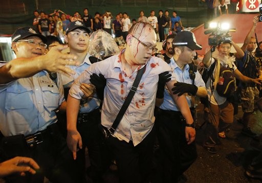 Một sinh viên biểu tình bị thương trong vụ ẩu đả với những người ủng hộ Bắc Kinh tối ngày 3/10.