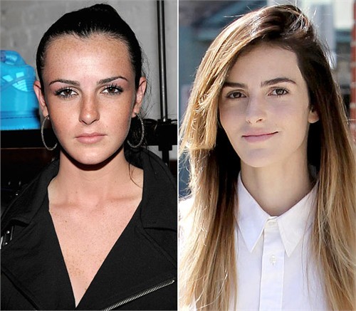 Ali Lohan. Mặc dù rất nhiều người tin rằng em gái của Lindsay Lohan đi dao kéo cả chục lần vì gương mặt của cô khác biệt rõ ràng nhưng mới đây, Ali khẳng định cùng tờ NY Post rằng tất cả chỉ là tin đồn vớ vẩn.