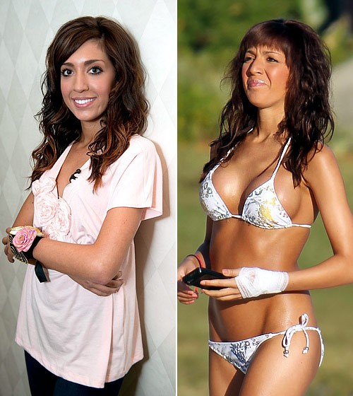 Farrah Abraham. Ngôi sao của series Teen Mom quyết định sửa ngực từ size A lên size C. Cô chia sẻ về quyết định chỉnh sửa của mình: "Tôi nghĩ là mình mất hết... vòng một từ khi sinh con".