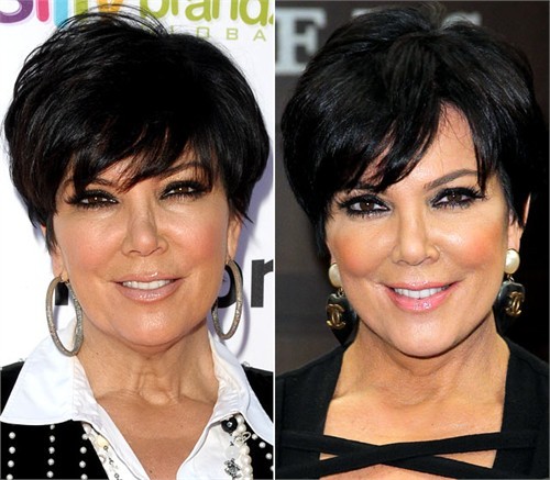 Kris Jenner. Mama tổng quản của các cô gái nhà Kardashian đã đi là mặt ngay trước đám cưới của con gái cưng là cô Kim siêu vòng ba. "Trông mẹ thật tuyệt vời," Kloe - một trong ba cô con gái của Kris Jenner chia sẻ cùng tờ NY Daily News. "Họ nói rằng chỉ vài tuần sau là mọi chuyện lại đâu vào đấy, các nếp nhăn lại xuất hiện nhưng mãi tới giờ, tôi thấy mẹ tôi vẫn xinh đẹp như thường".