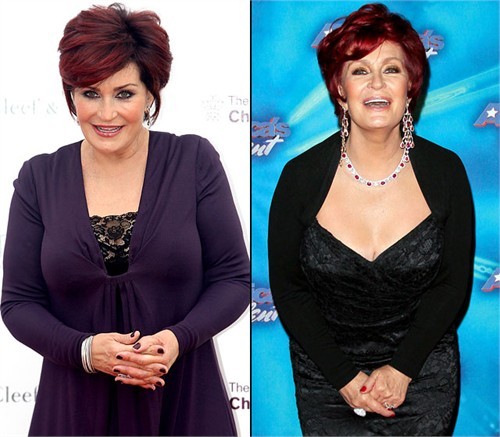 Sharon Osbourne. Nữ chủ nhân của chương trình Talk tiết lộ đã sửa lại vòng một sau khi một trong những túi silicon bà sử dụng trước đây bị rò rỉ. Sau ca phẫu thuật này, Sharon tự tin chia sẻ: "Tôi cảm thấy nhẹ nhàng hơn nhiều. Trước đây tôi luôn có cảm giác cơ thể mình lõng bõng nước".