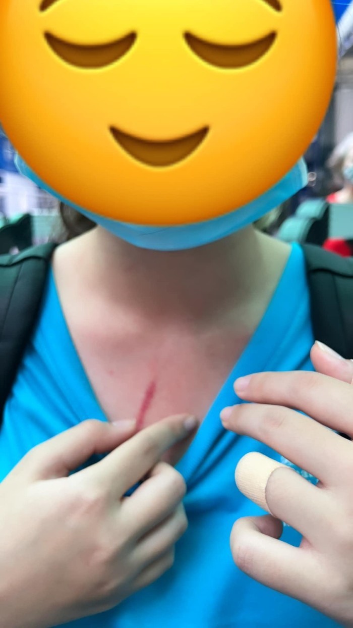 Vết xước trên cổ được cho là của con gái của chị T. (Ảnh: Facebook T.H.T.) ishcmcfb-7468.jpg
