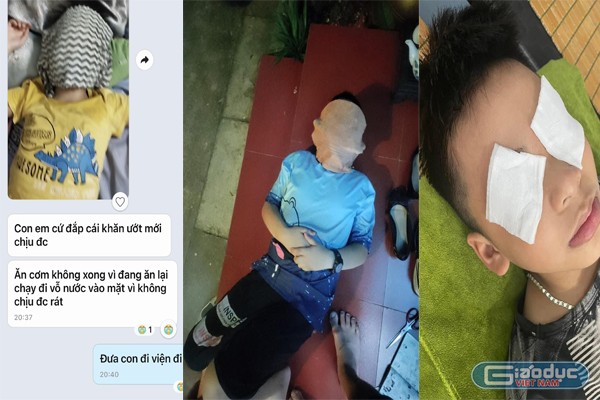 Nhiều trường hợp bị rát da mặt, mắt nên phải đắp khăn mặt ướt. (Ảnh: Phụ huynh cung cấp) gdvn_hoc-sinh-th-hai-boi-bi-di-ung-thuoc-muoi 333.jpg