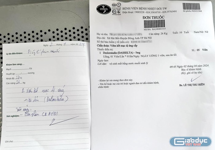Ngày 2/4, con của chị Tr. đi khám tại bệnh viện và được chẩn đoán là viêm kết mạc dị ứng cấp. (Ảnh: NVCC) gdvn_th-hai-boi.jpg
