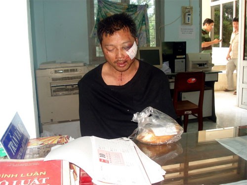 Chưa tìm thấy số vàng bị cướp ở Bình Thuận ảnh 1 Chưa tìm thấy số vàng bị cướp ở Bình Thuận ảnh 1